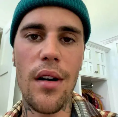 Justin Bieber choc: "Un virus mi ha paralizzato metà faccia. Non so quando tornerò sul palco"