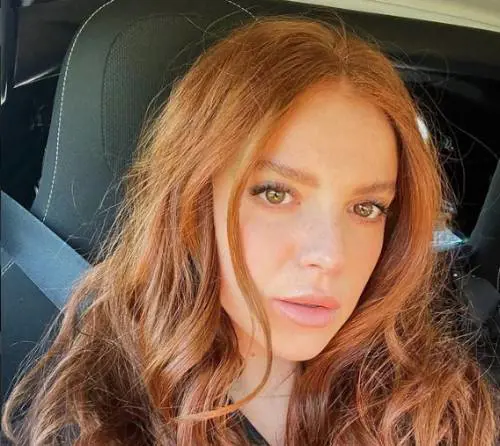 Trova l'auto sui ceppi. La rabbia di Ludovica Bizzaglia: "Questo succede a Roma"