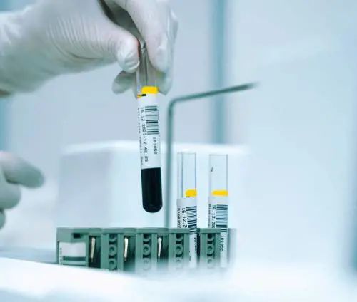 Scovare un tumore con le analisi del sangue: come funziona il test