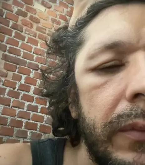 Ermal Meta preoccupa i fan: "Mi si gonfiano parti del viso e della testa"