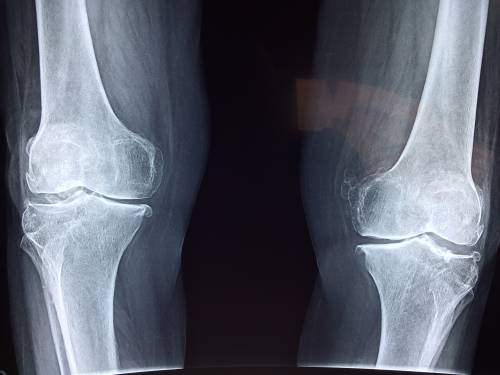Raggi alla caviglia senza la biancheria intima: denunciato tecnico radiologo