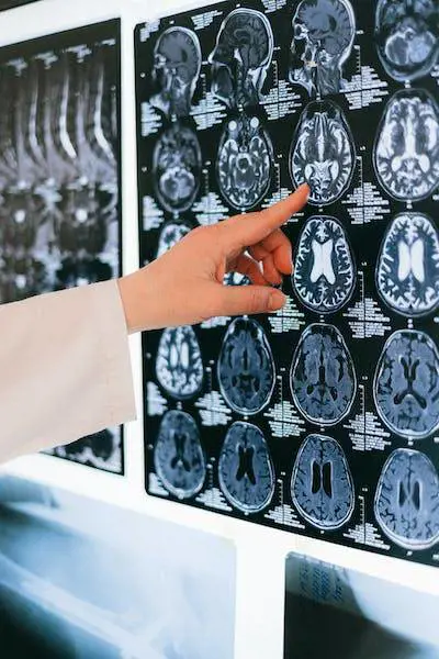 Egoisti o altruisti? Dipende (anche) dall’amigdala