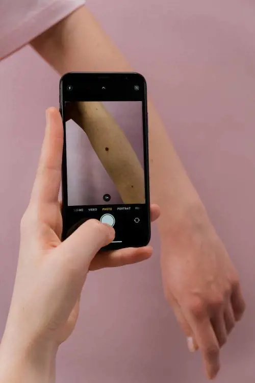 Teledermatologia: cos'è, come funziona e quali sono i vantaggi