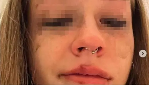 "Ecco chi è". La foto choc della 18enne contro l'ex, lui la querela
