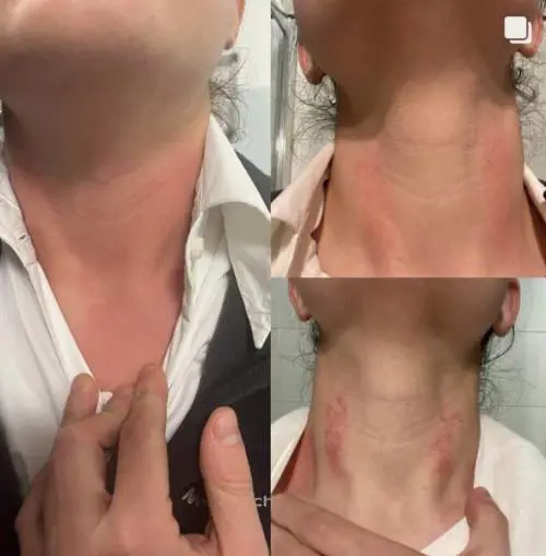 Dottoressa aggredita: "Pronta a lasciare il lavoro..."
