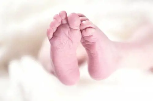 Diventa madre anche se malata di sindrome rara. "Un caso unico"