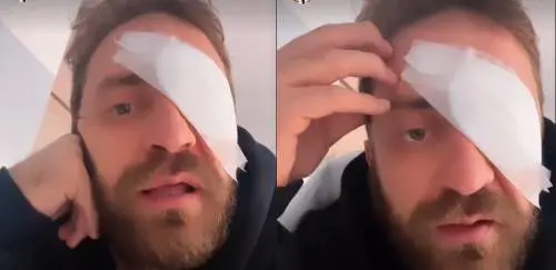 Stefano Corti ricoverato d'urgenza: cosa è successo alla "Iena"