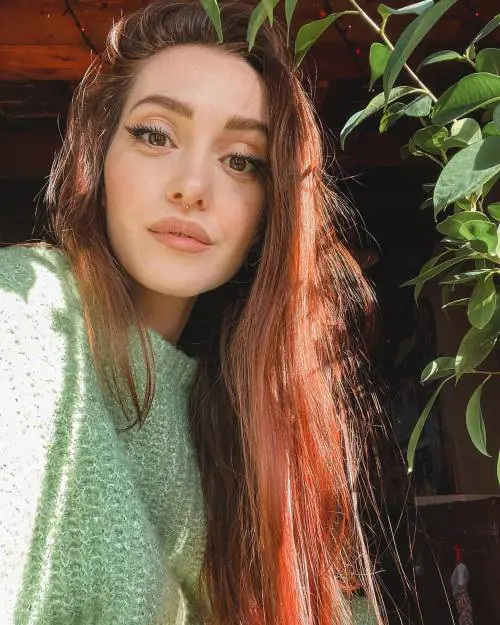 Cos'è la tricodinia, il problema ai capelli dell'influencer Camihawke