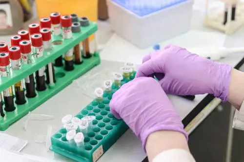 Artrite reumatoide: nuove speranze di cura