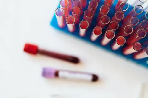 Tumori del sangue, identificato un nuovo metodo per prevenirli