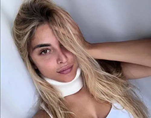 Claudia Motta e Simone Rugiati sono in crisi? Il gossip dopo l'infortunio all'Isola dei Famosi