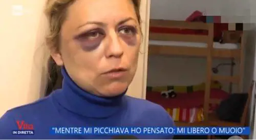 "Ho pensato di morire". Il racconto choc della donna aggredita in casa