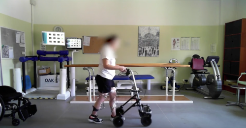 Paralizzata torna a camminare dopo 5 anni: straordinario intervento al San Raffaele