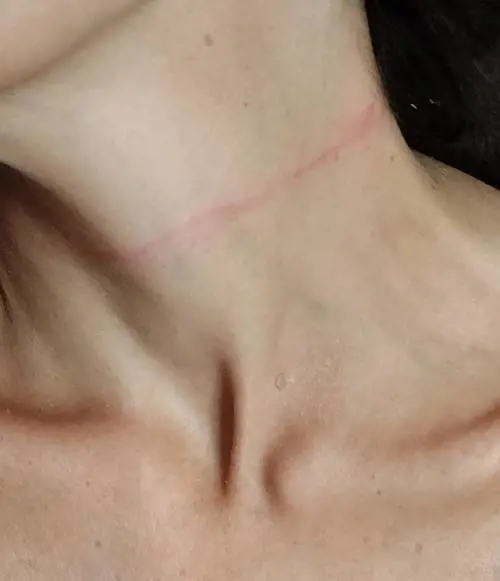 "Mi ha strappato la catenina, ero in trappola". L'incubo di una studentessa a Milano