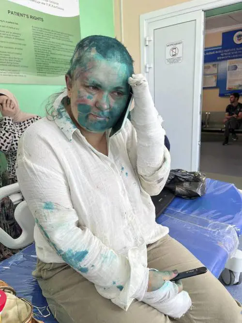 "Smetti di scrivere". Giornalista russa di Novaya Gazeta colpita con la vernice tossica