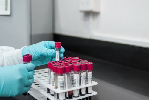 L'esame del sangue per scoprire 50 tipi di cancro: cos’è il Test di Galleri