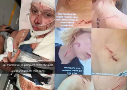 Sfigurata da quattro magrebini perché il suo abbigliamento è "immorale"