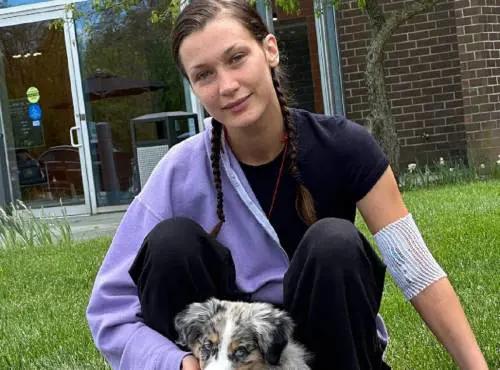 "Dopo anni di cure sono guarita". Bella Hadid esce dall'incubo