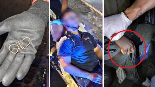 Agente ferito dallo straniero: “Vi uccido”. Paura per la nuova ‘arma’