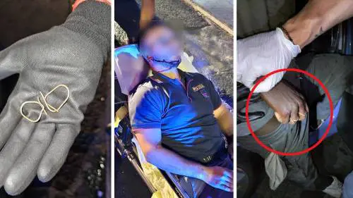 L'anello a forma di uncino: l'arma choc contro i poliziotti