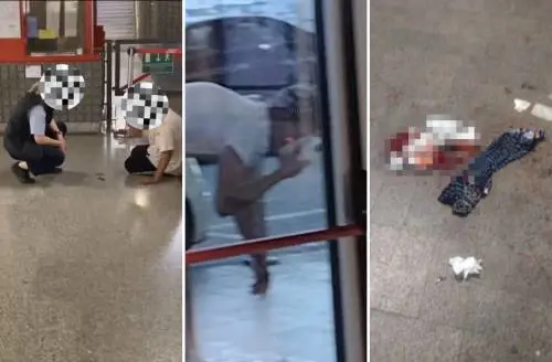Aggressione horror in Porta Garibaldi: turista accoltellato al volto. Il video choc