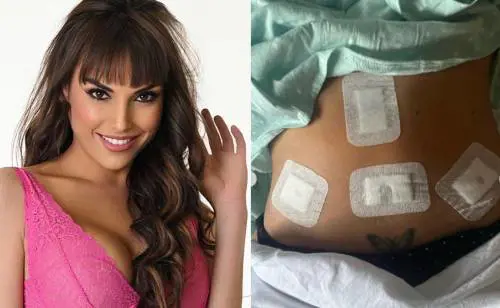 Francesca De Andrè operata d'urgenza: "Mi hanno trovato delle masse nell'utero, non posso più avere figli”