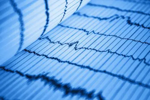 L’IA previene gli infarti: come funziona