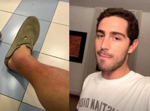 "Sospetta trombosi". Tommaso Zorzi finisce in ospedale, ma la diagnosi è un'altra