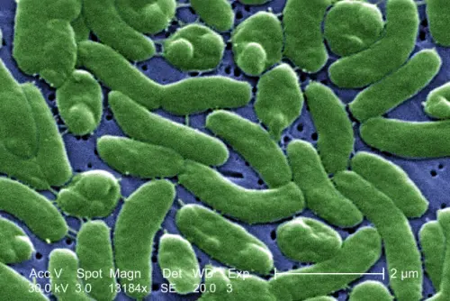 Un taglio, poi l'infezione: il 49enne di Trani rischia la vita per il "batterio mangiacarne"
