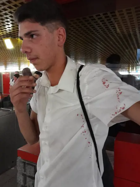 Pestato a sangue in metropolitana dalle "guardie del corpo" di una borseggiatrice