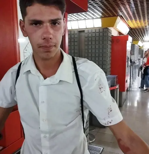 Milano, picchiato a sangue dai body guard delle borseggiatrici