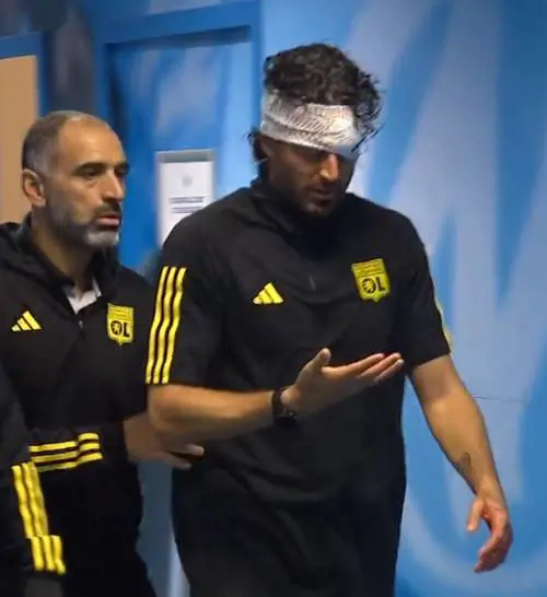 Lancio di sassi, ferito Grosso prima del match con Gattuso