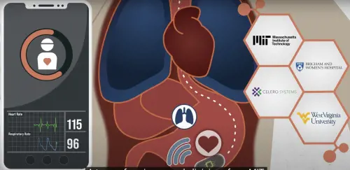 Pillola "smart" per monitorare i segnali vitali: come funziona