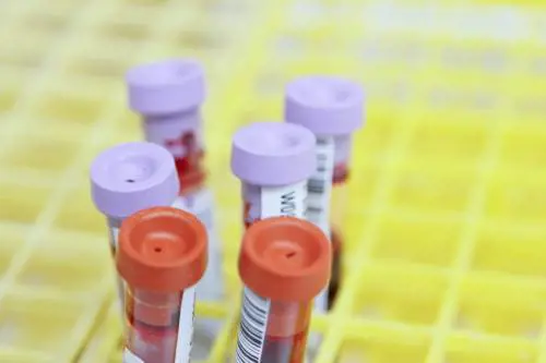 Un organo invecchia prima. E il sangue ci rivela qual è