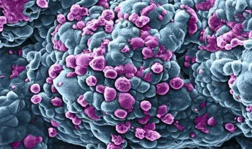 Tumori, in crescita le diagnosi in Italia. Il più comune quello al seno: i dati