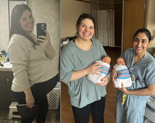 "Gemelle - Sorelle", una donna con doppio utero rimane incinta di due singole bambine 