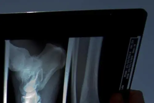 Costrette a spogliarsi e fotografate di nascosto: la violenza del radiologo a Varese
