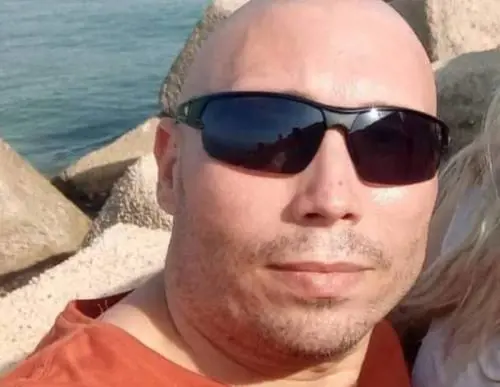 Sfregiato con l'acido dalla ex, nuovi arresti in vista