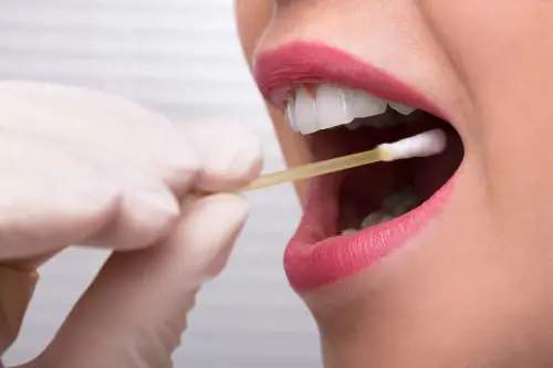 3 cose da sapere sul test diagnostico salivare per l'endometriosi