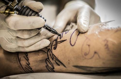Tatuaggi, quanto (dolore) costa rimuoverli