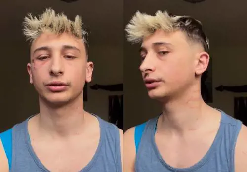 Aggredito George Ciupilan. L'ex gieffino sui social con gli ematomi sul volto