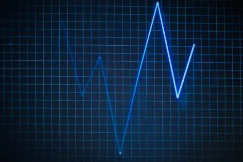 Intervento di cardiochirurgia con la realtà aumentata: il primo in Italia