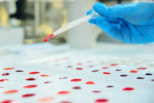 Tutto quello che c'è da sapere sui gruppi sanguigni: perchè è importante conoscerli (soprattutto il proprio)