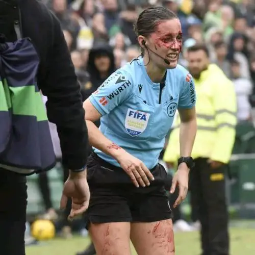 Il guardalinee, il volto pieno di sangue e il trauma: cos'è successo in Liga