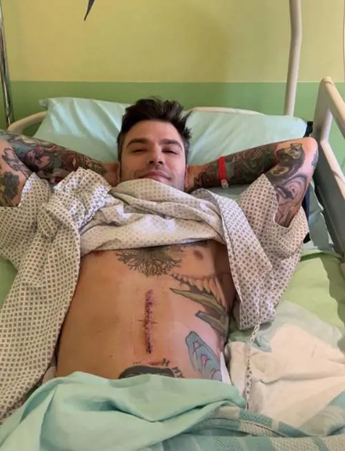 "Avevamo un patto, ma non lo ha mantenuto". Parla il chirurgo che ha operato Fedez