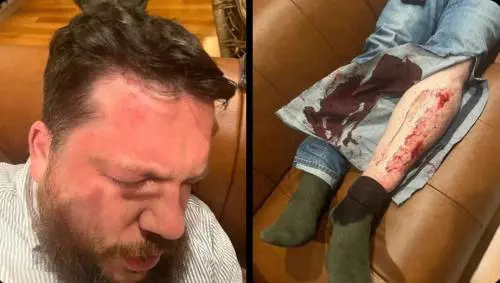 Volkov preso a martellate, la lunga mano di Mosca
