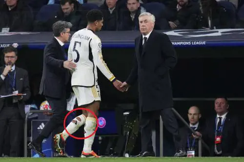 Ecco perché i calciatori tagliano i calzettoni