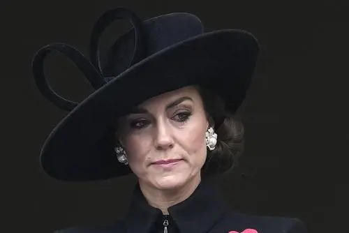 I polipi, i diverticoli, il tumore. Le ipotesi del chirurgo sull'intervento di Kate