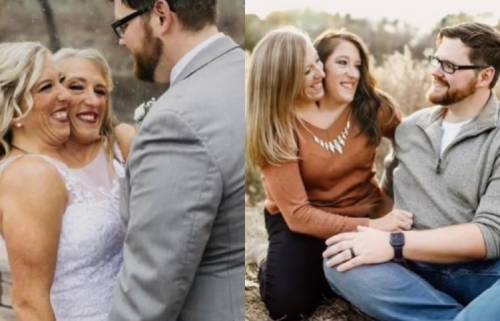Gemelle siamesi dicefale si sposano: il video diventa virale