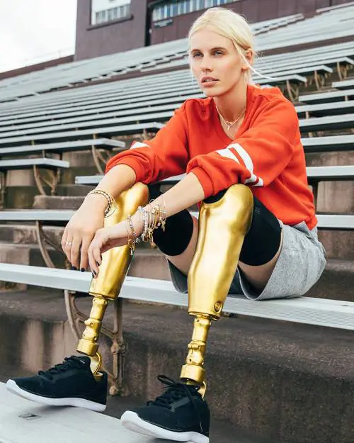 Perde le gambe per colpa degli assorbenti. Cos'è successo alla modella